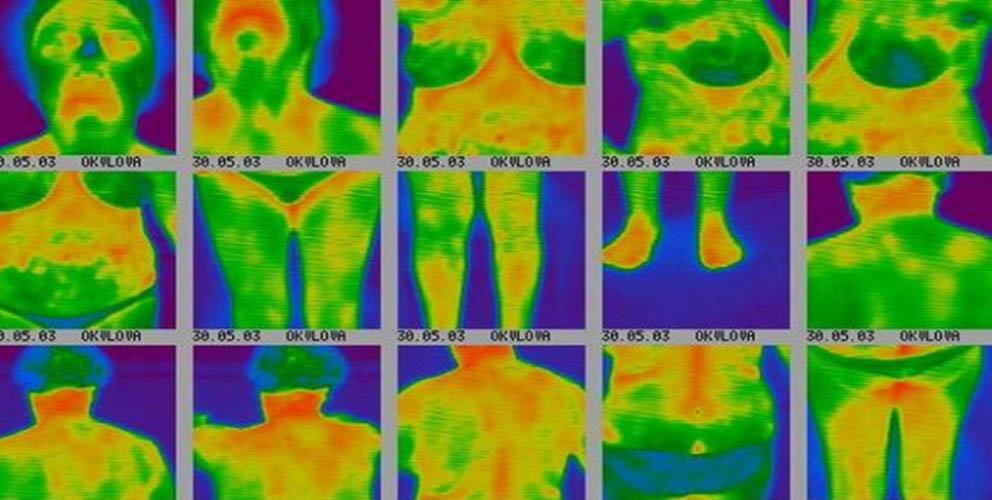 Медицинские тепловизоры
